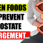 Eat These 7 Foods to Prevent Prostate Enlargement