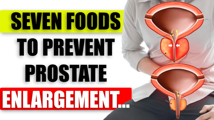 Eat These 7 Foods to Prevent Prostate Enlargement